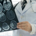 Laikus nediagnosticēta un neārstēta galvas asinsvadu aneirisma ir ievērojams risks pacienta dzīvībai.