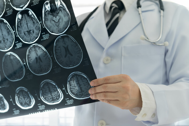 Laikus nediagnosticēta un neārstēta galvas asinsvadu aneirisma ir ievērojams risks pacienta dzīvībai.