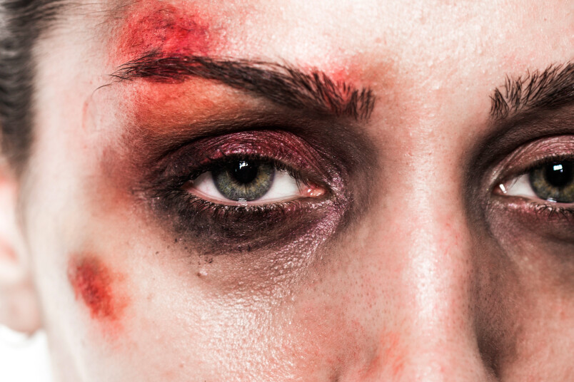 Veselības aprūpes sistēmai jākļūst par drošu pirmo pieturvietu vardarbībā cietušām sievietēm un meitenēm