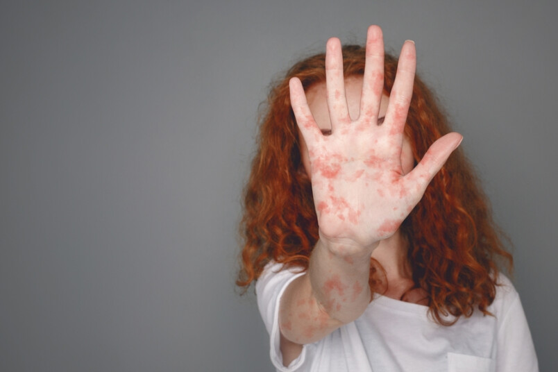 Masalas vēl nav palikušas pagātnē.