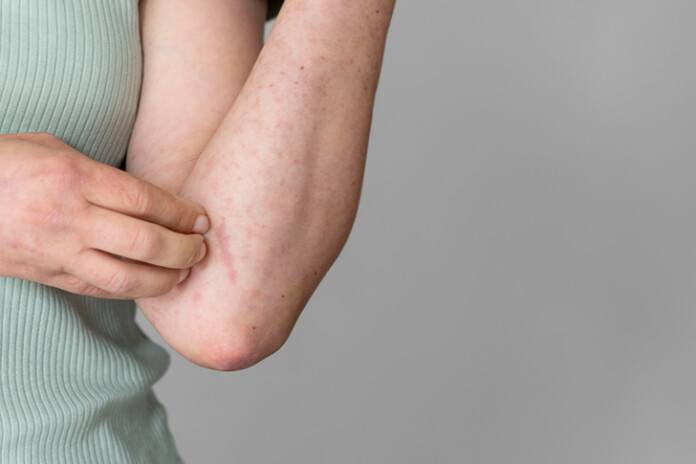 Daudzi pacienti ziņo, ka dienas laikā simptomi var būt ciešami vai pat nemanāmi.