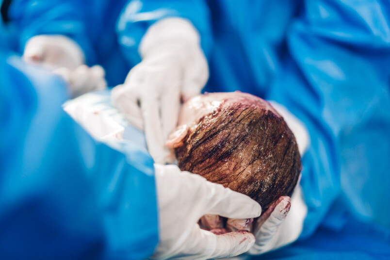 Ilustratīvs attēls